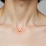 Dermals – Types, Aftercare & Piercing Guide